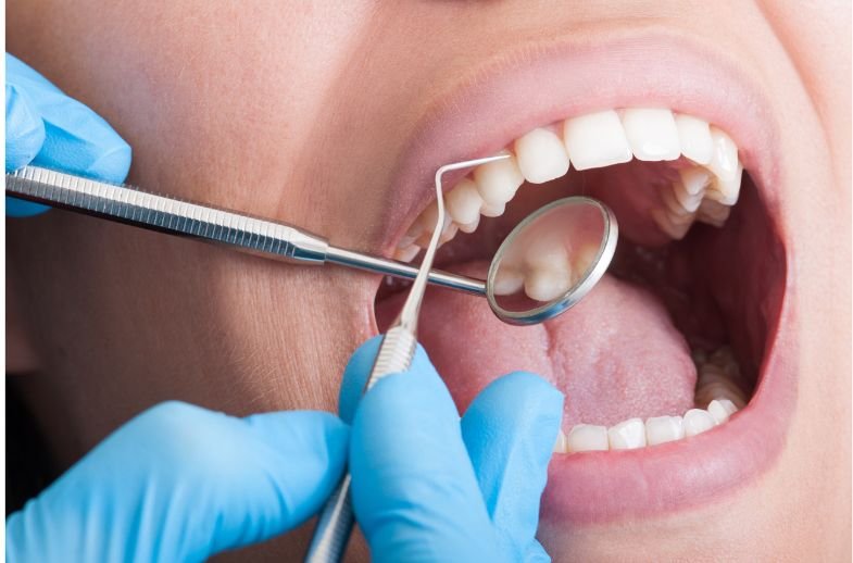 What Is Deep Teeth Cleaning?