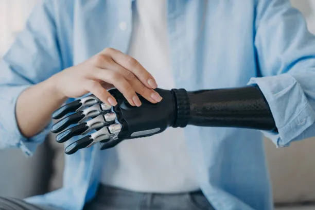 Cyborg Medical Prosthetics