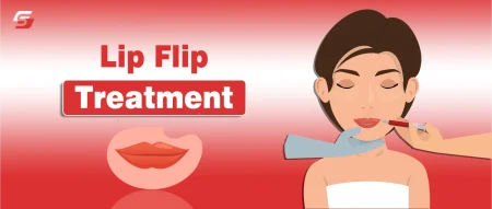 Lip Flip Treatment: Cost, Results & Risks You Should Know Lip Flip Treatment
